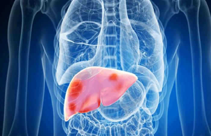 النظام الغذائي والرياضة.. مفتاح صحة الكبد