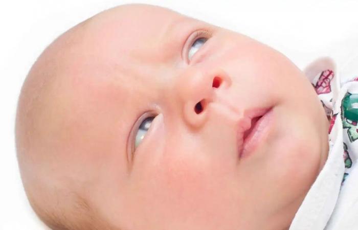 "اهتزاز العينين" عند الأطفال.. متى يكون مؤشراً للمرض وما هي سبل العلاج